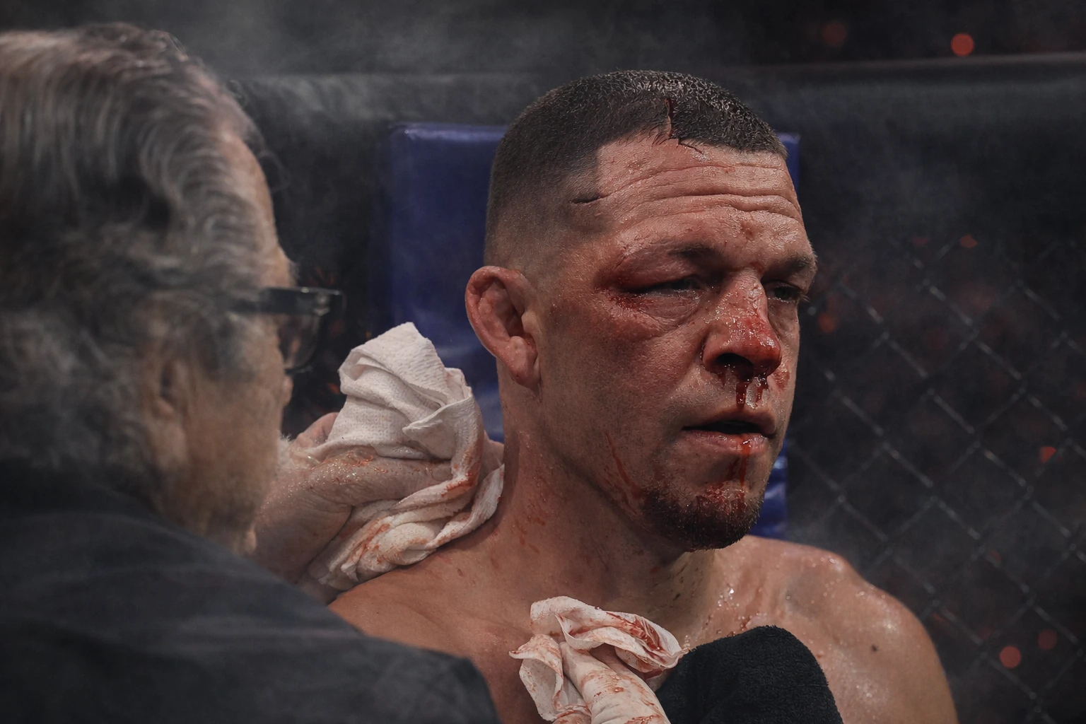 Cutman Jacob ‘Stitch’ Duran Details Call to Stop Nate Diaz Fight