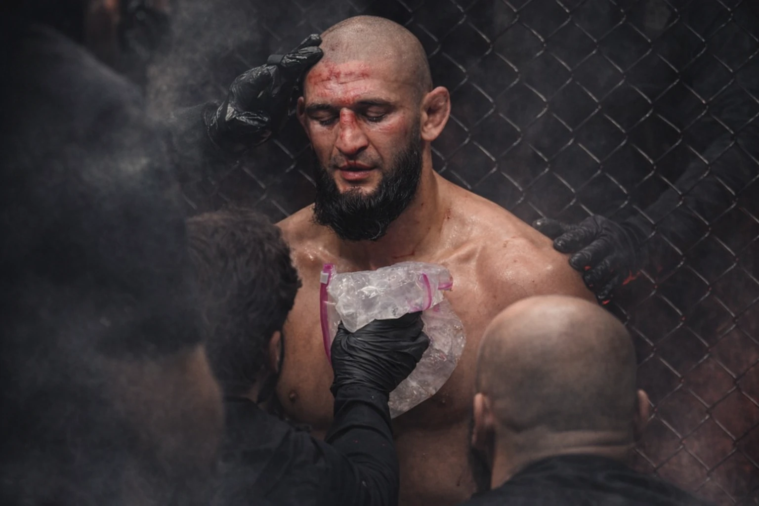 Khamzat Chimaev’s Team Reveals Severe UFC 328 Weight-Cut Struggles, Wants Rematch